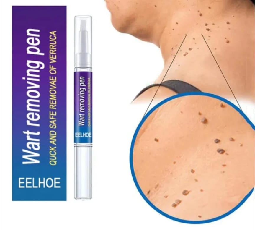 Wart Removal Pen & Wartner Verruca, Removal Of Warts Liquid Pen Woman Skin Care Removing Against Moles Pimple Patch Remove Black Dot