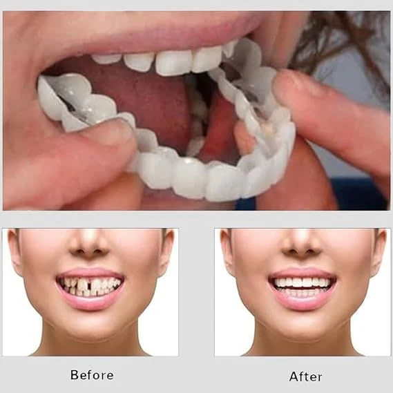 New 2PC ADJUSTABLE SNAP ON SMILE VENERS FOR MEN AND WOMEN